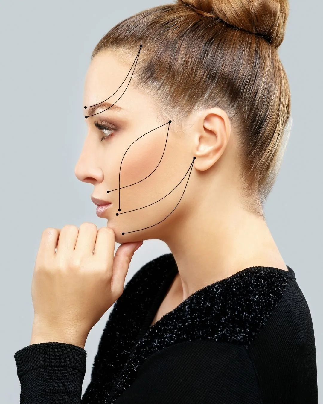 Thread Lift – İp Askı