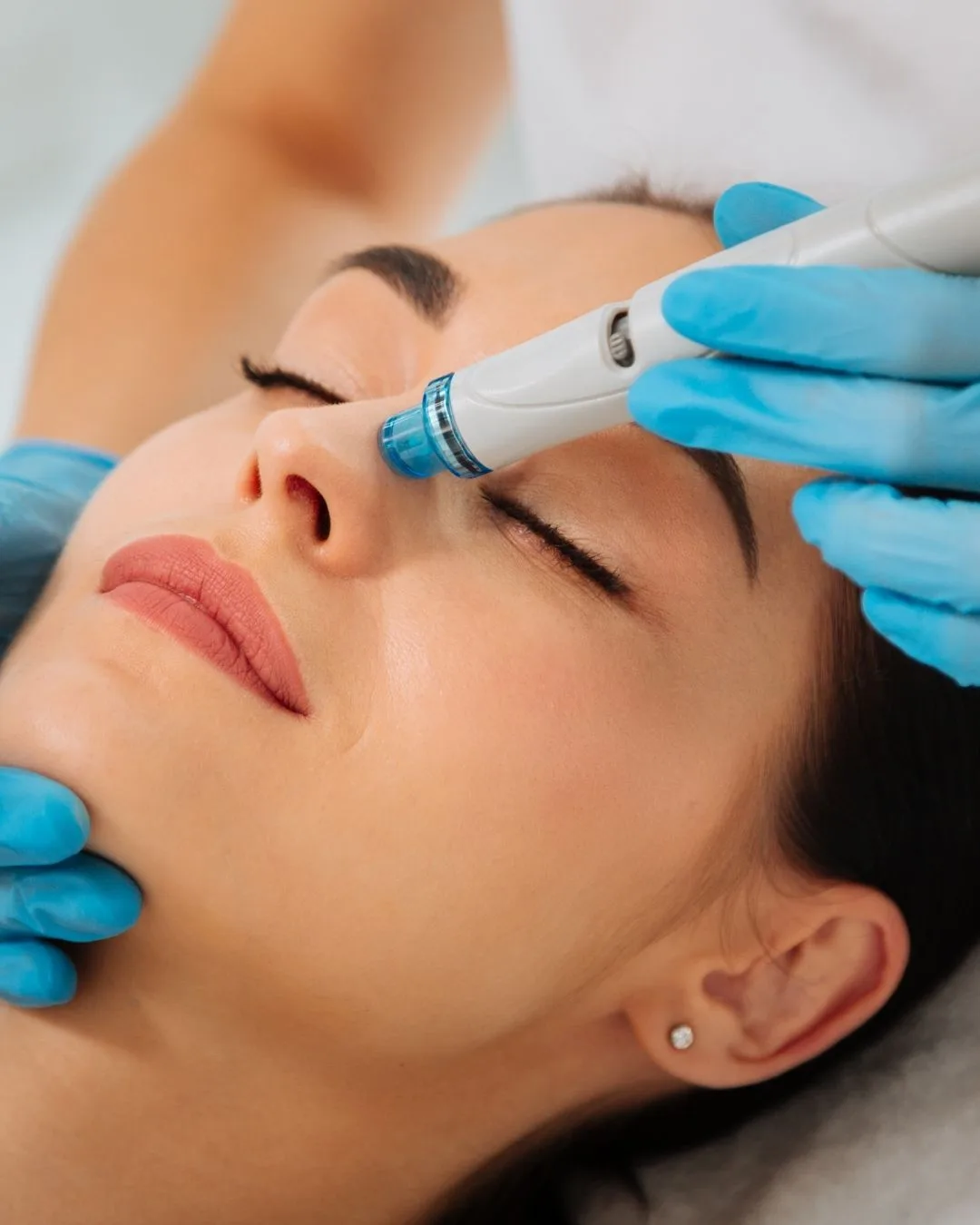 HydraFacial