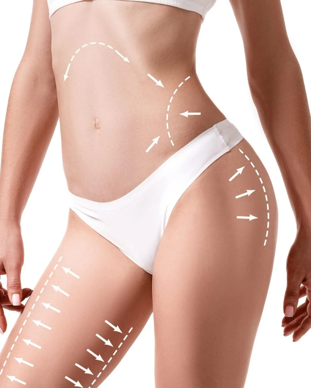 Erkek VASER Liposuction